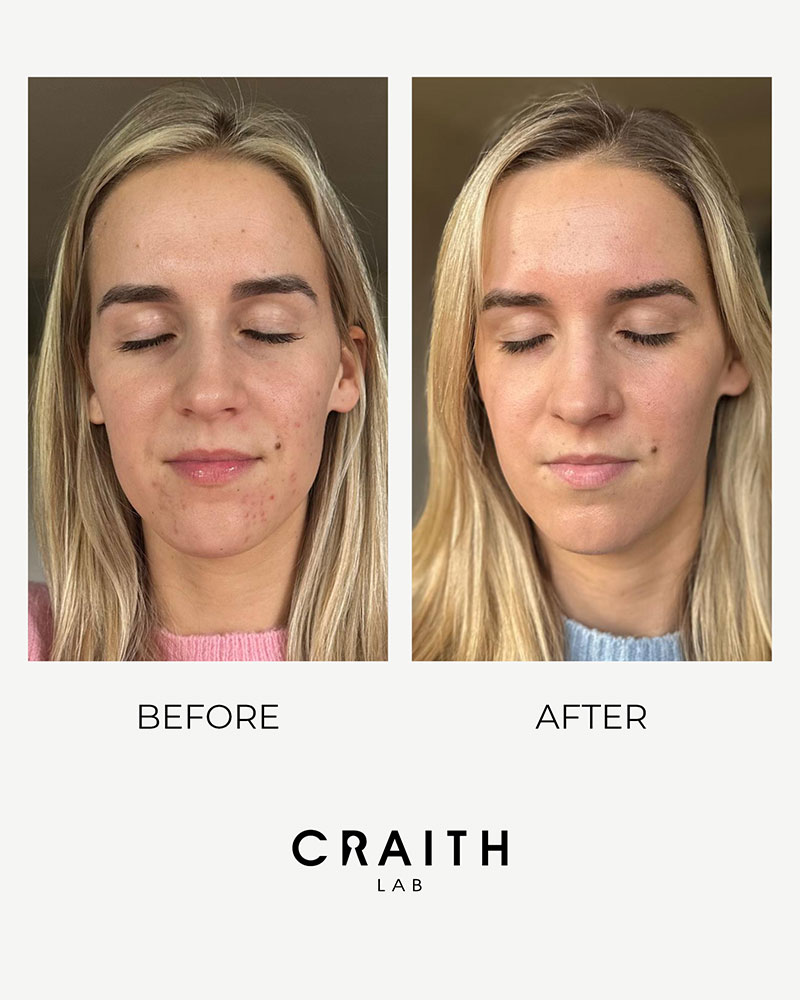 Craith Lab Anwendung